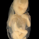 Fetus on Black